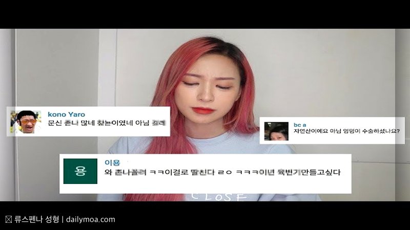 류스펜나 성형